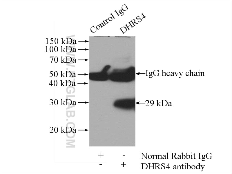Immunoprecipitation (IP) experiment of mouse liver tissue using DHRS4 Polyclonal antibody (15279-1-AP)