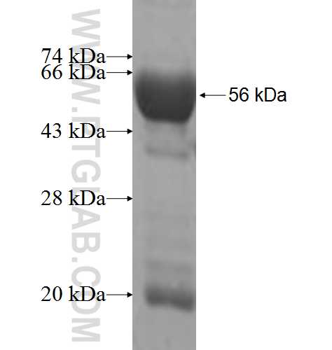DHRS4 fusion protein Ag7398 SDS-PAGE