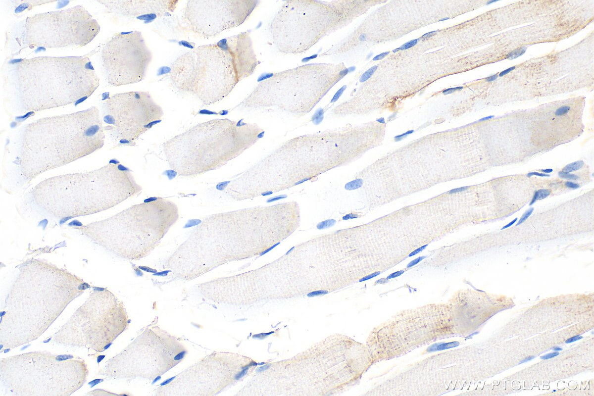 Immunohistochemistry (IHC) staining of rat skeletal muscle tissue using DHRS7 Polyclonal antibody (15061-1-AP)