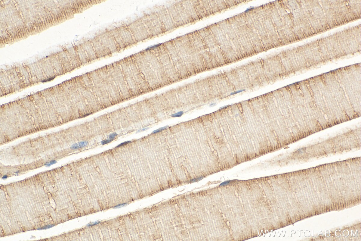 Immunohistochemistry (IHC) staining of mouse skeletal muscle tissue using DHRS7 Polyclonal antibody (15061-1-AP)