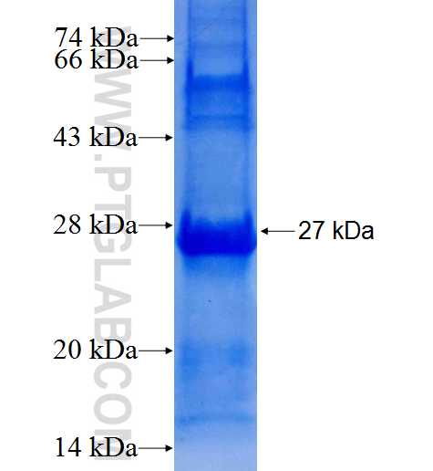 DHRS7 fusion protein Ag7046 SDS-PAGE