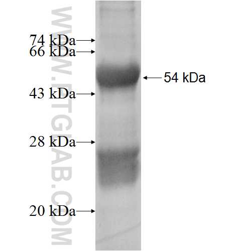 DHRS7 fusion protein Ag7064 SDS-PAGE
