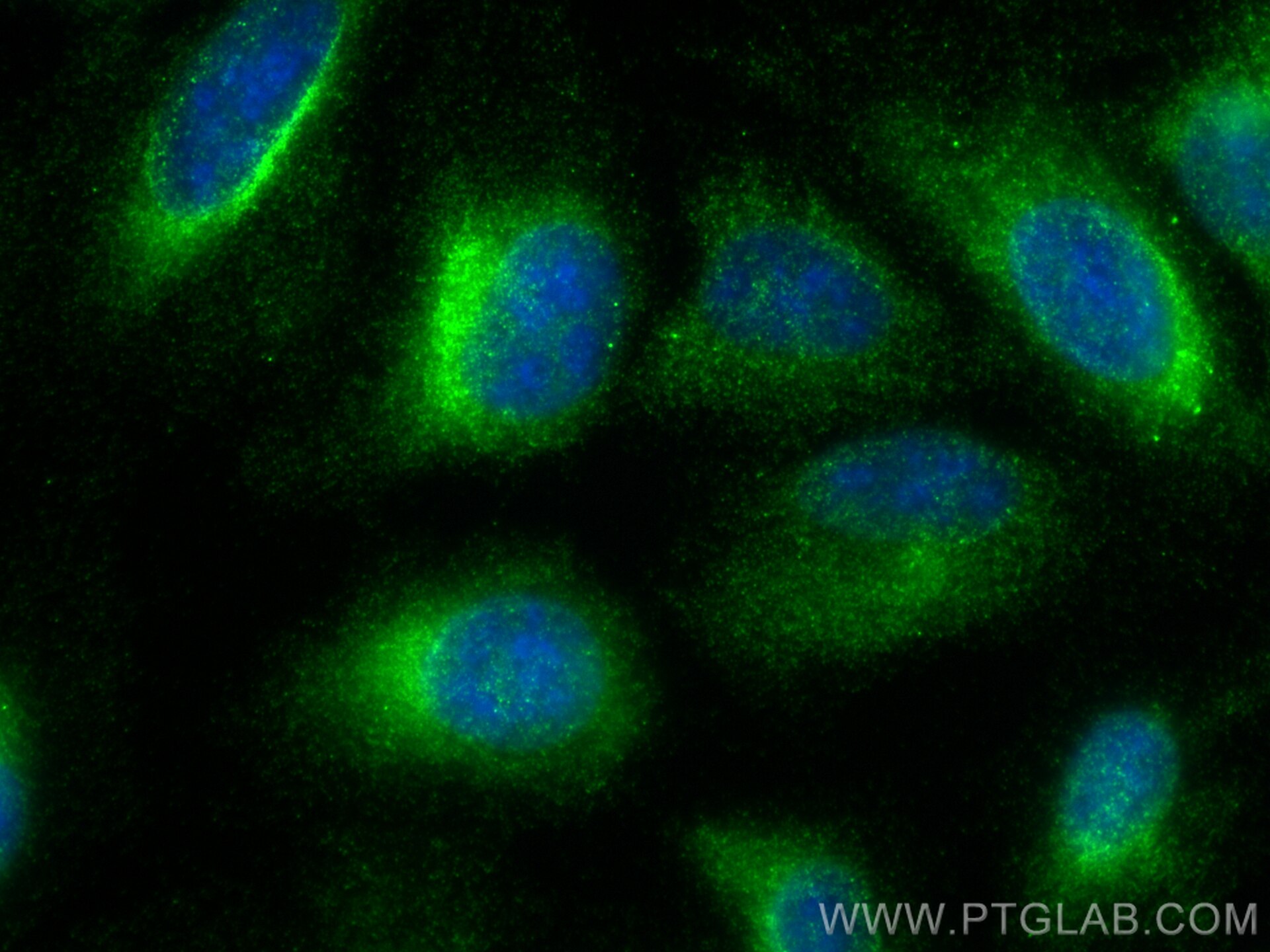 Immunofluorescence (IF) / fluorescent staining of U2OS cells using DHRS7B Polyclonal antibody (15530-1-AP)