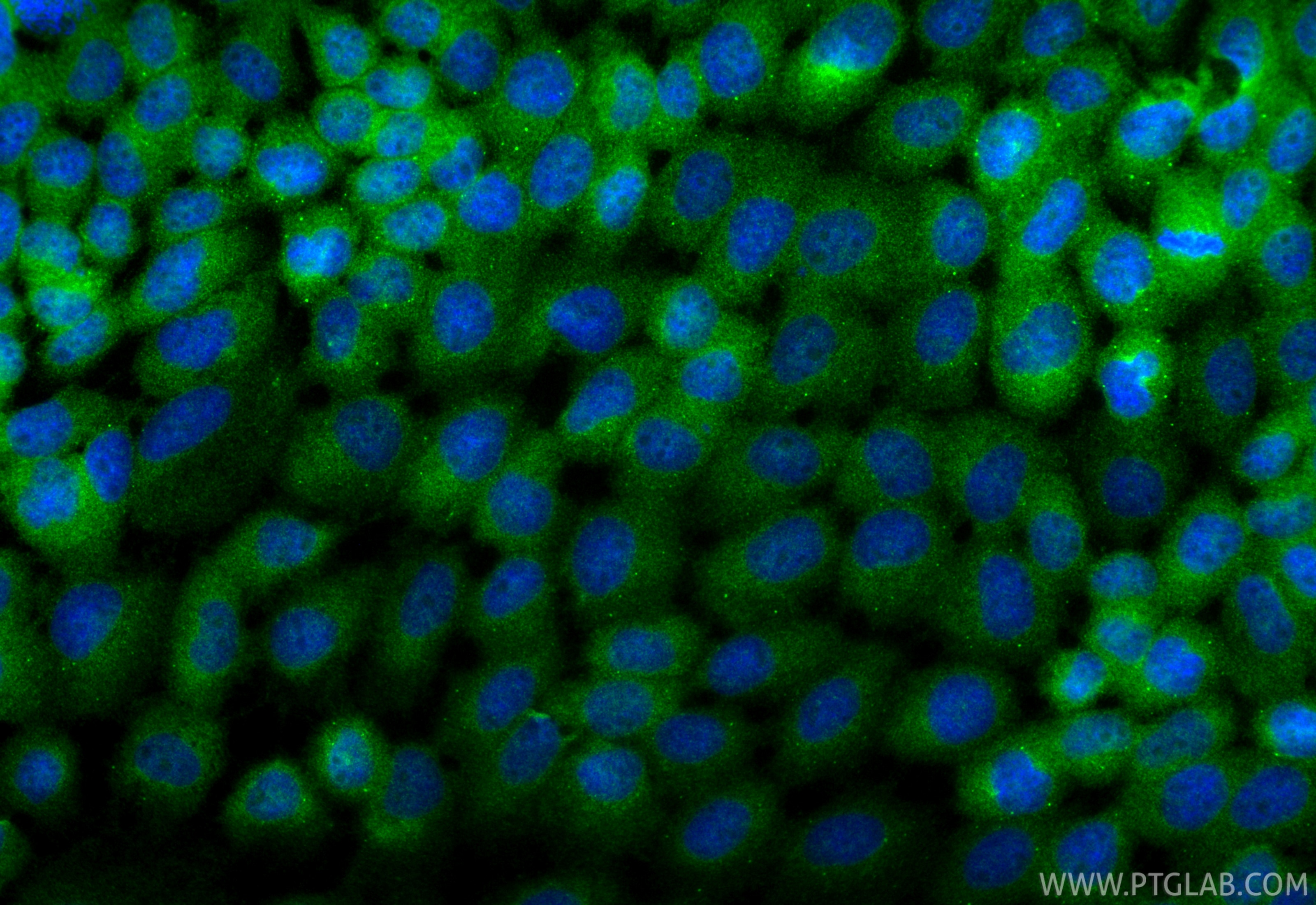Immunofluorescence (IF) / fluorescent staining of A431 cells using DHRS7B Polyclonal antibody (15530-1-AP)