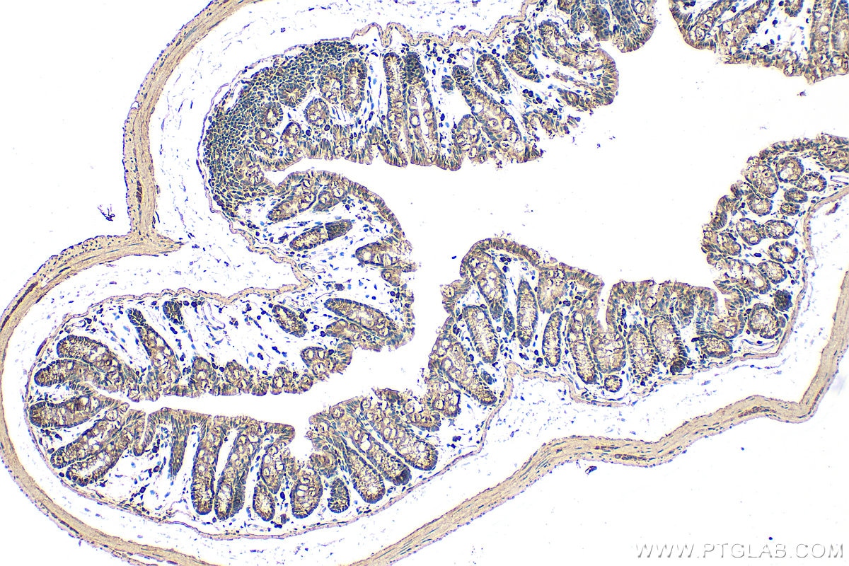 Immunohistochemistry (IHC) staining of mouse colon tissue using DHRS7B Polyclonal antibody (15530-1-AP)