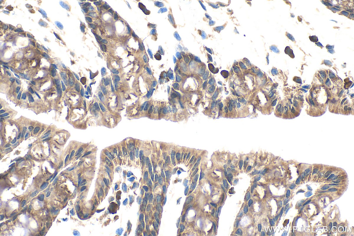 Immunohistochemistry (IHC) staining of mouse colon tissue using DHRS7B Polyclonal antibody (15530-1-AP)