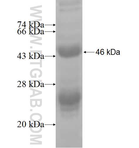 DHRS7B fusion protein Ag7690 SDS-PAGE