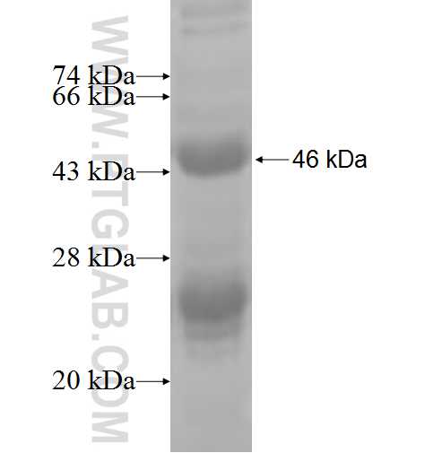 DHRS7B fusion protein Ag7690 SDS-PAGE