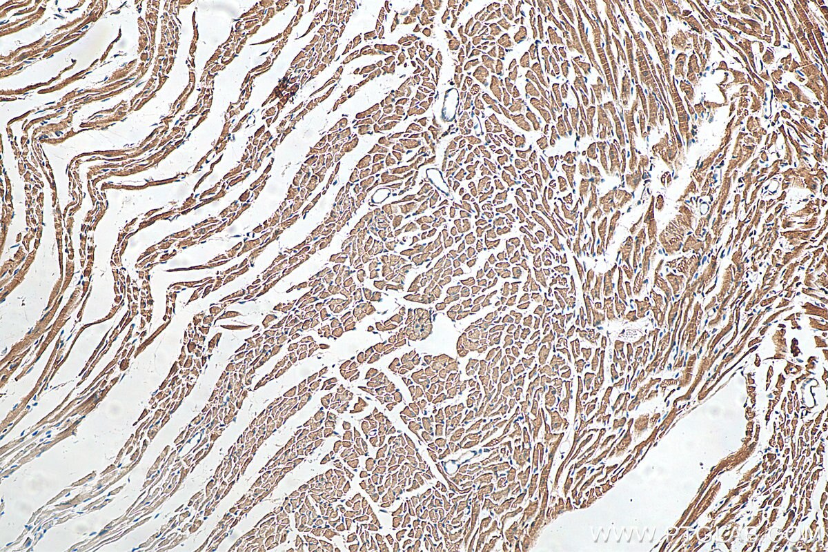 Immunohistochemistry (IHC) staining of mouse heart tissue using DHRS7C Polyclonal antibody (26020-1-AP)