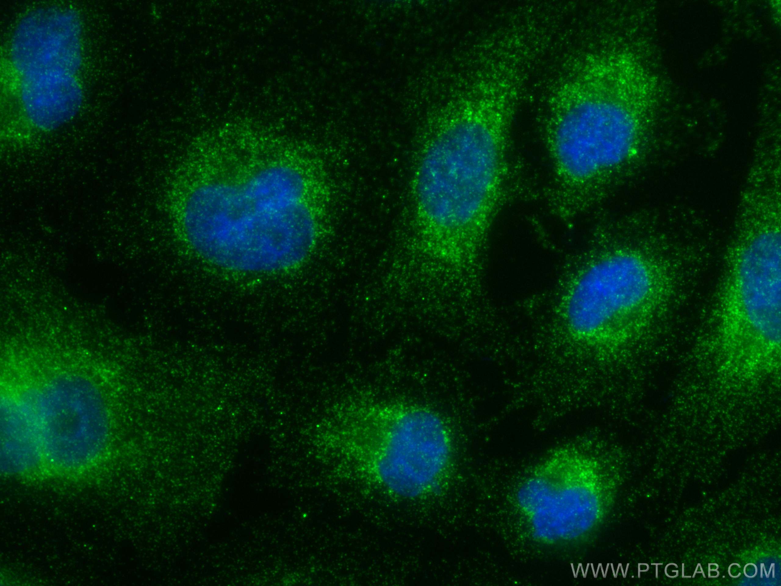 IF Staining of A549 using 14560-1-AP