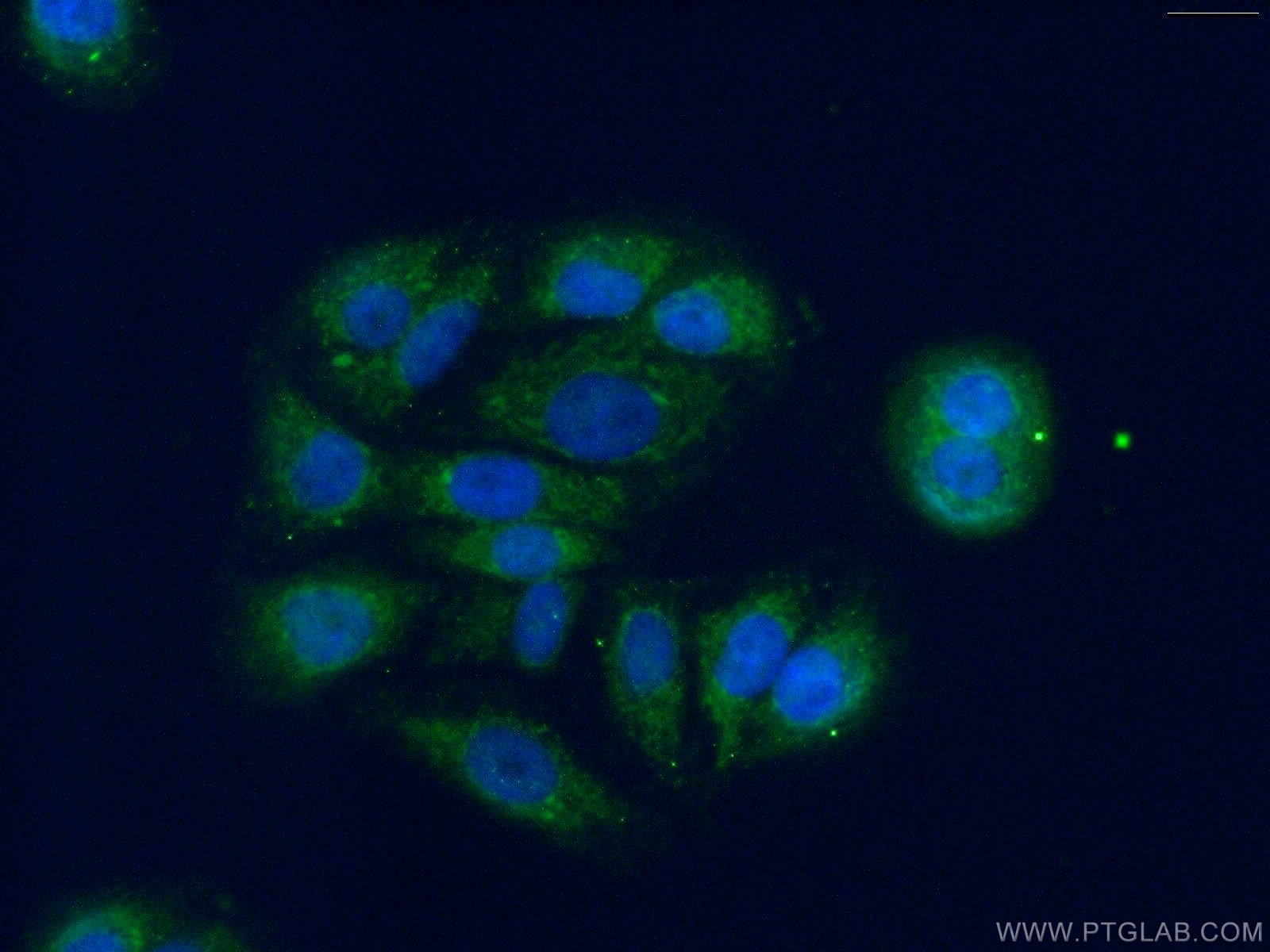 Immunofluorescence (IF) / fluorescent staining of A549 cells using DHRS9 Polyclonal antibody (14560-1-AP)