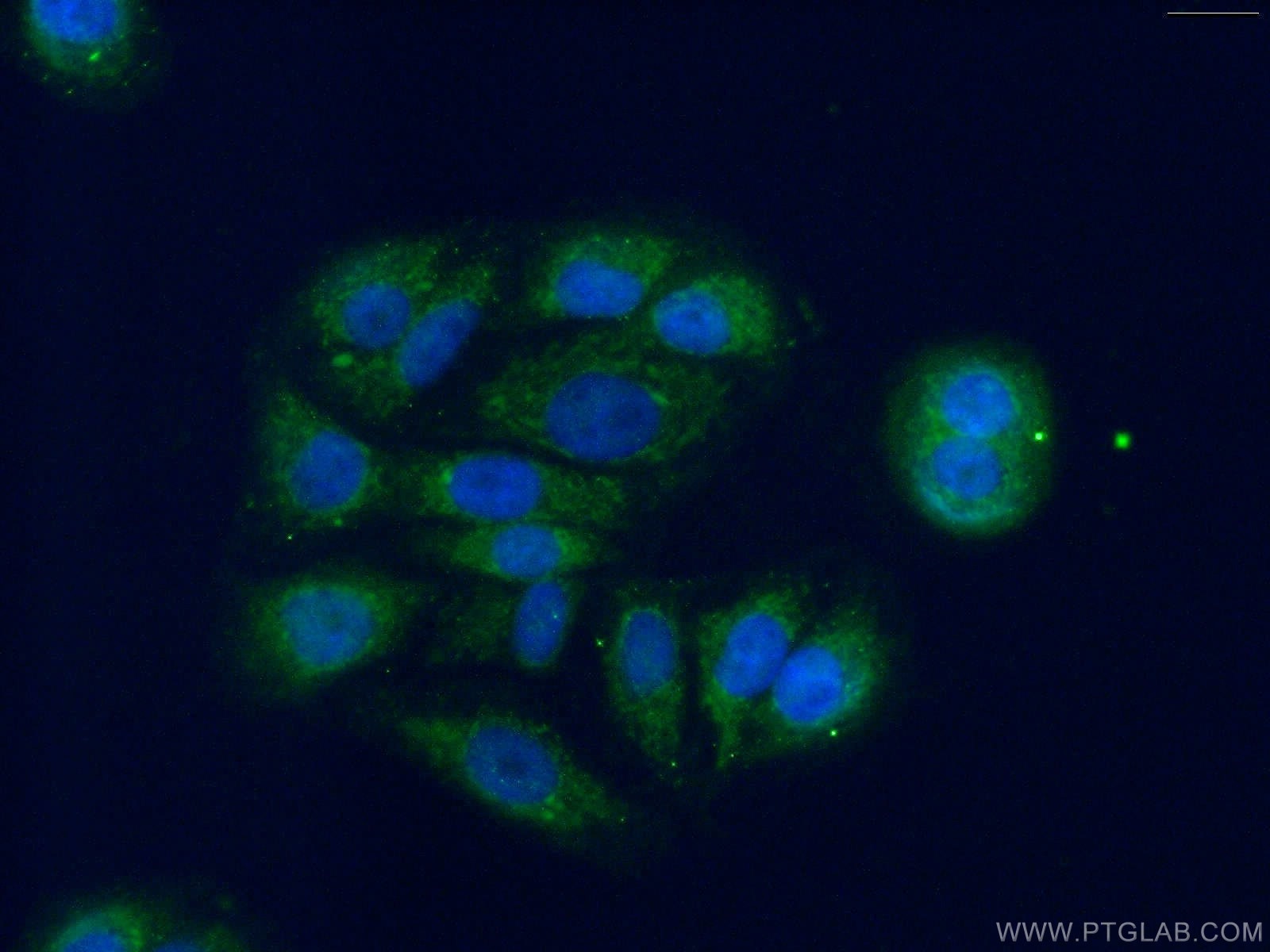 IF Staining of A549 using 14560-1-AP