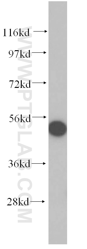 Western Blot (WB) analysis of HeLa cells using DHRS9 Polyclonal antibody (14560-1-AP)