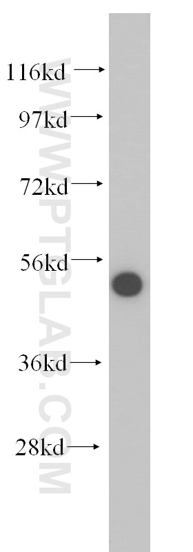 Western Blot (WB) analysis of mouse trachea tissue using DHRS9 Polyclonal antibody (14560-1-AP)