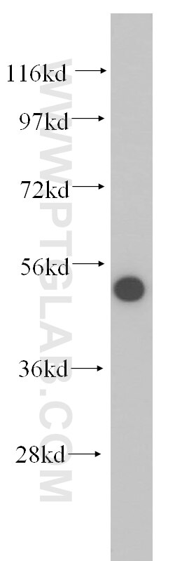 WB analysis of mouse trachea using 14560-1-AP