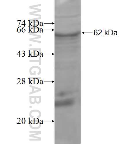 DHRS9 fusion protein Ag6116 SDS-PAGE