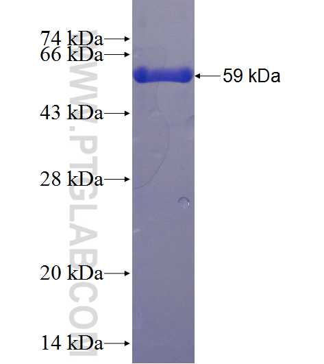 DHRSX fusion protein Ag11046 SDS-PAGE