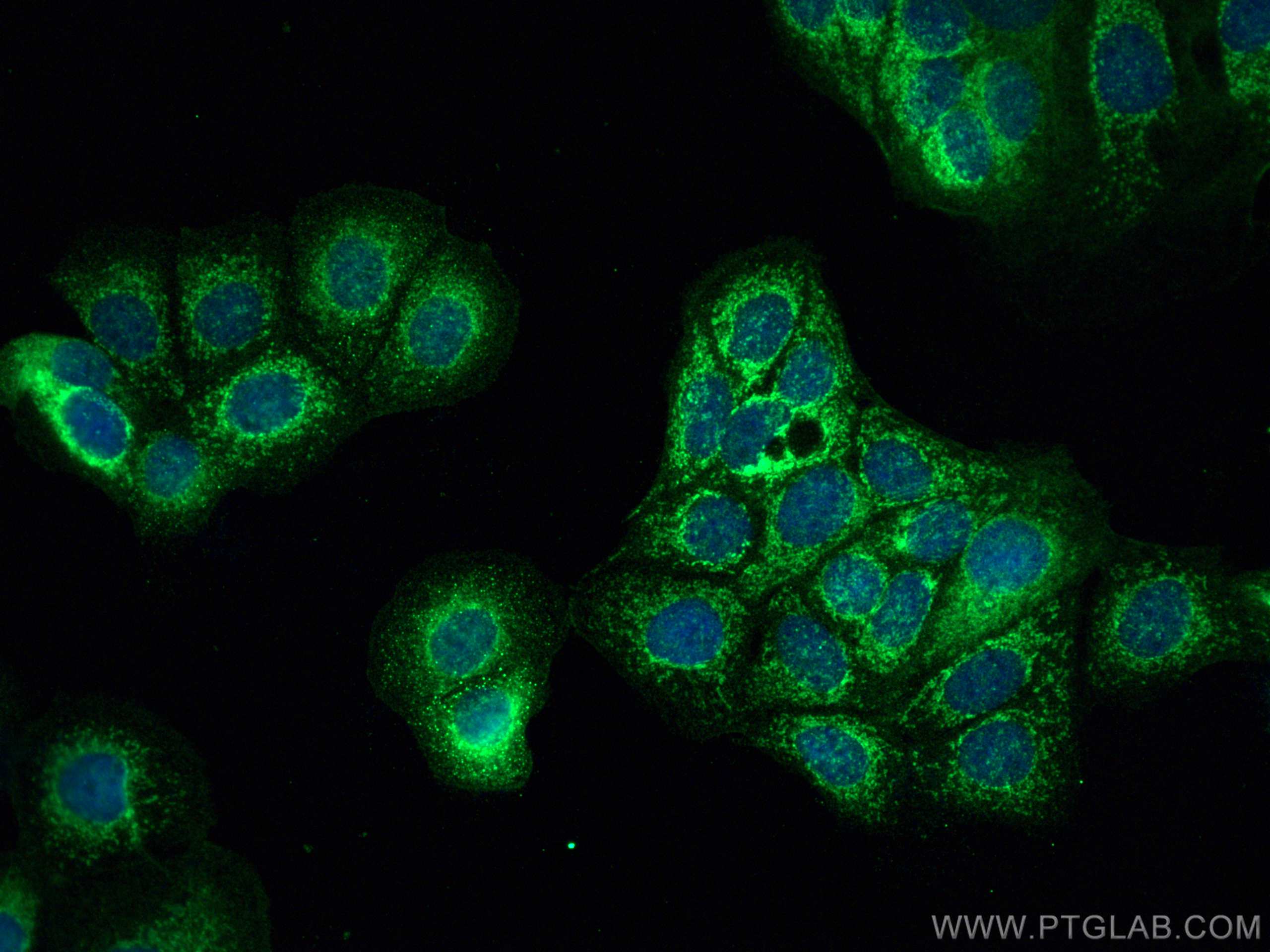 Immunofluorescence (IF) / fluorescent staining of MCF-7 cells using DHTKD1 Polyclonal antibody (27493-1-AP)