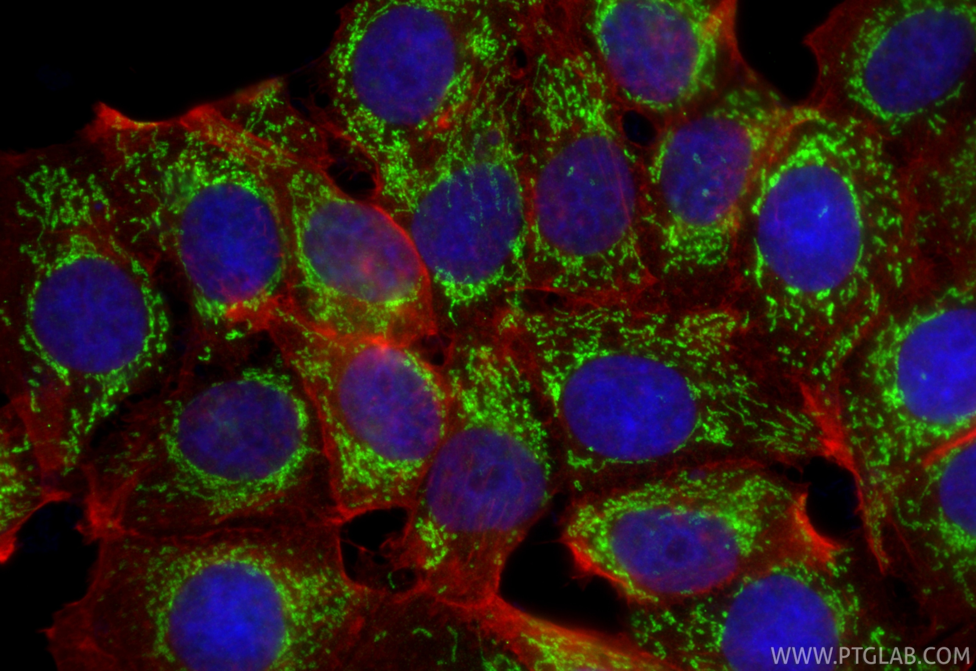 Immunofluorescence (IF) / fluorescent staining of MCF-7 cells using DHTKD1 Polyclonal antibody (27493-1-AP)