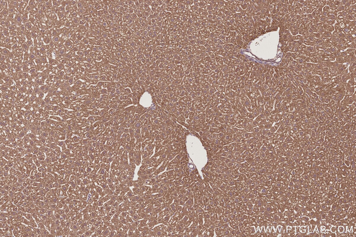 Immunohistochemistry (IHC) staining of mouse liver tissue using DHTKD1 Polyclonal antibody (27493-1-AP)