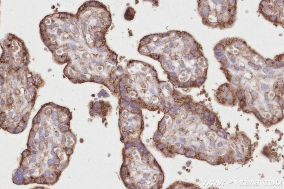 Immunohistochemistry (IHC) staining of human placenta tissue using DHTKD1 Polyclonal antibody (27493-1-AP)