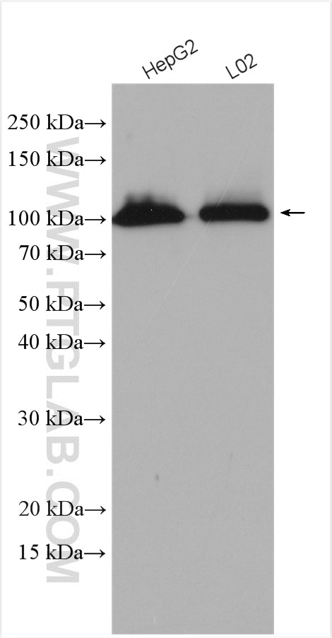 Western Blot (WB) analysis of various lysates using DHTKD1 Polyclonal antibody (27493-1-AP)
