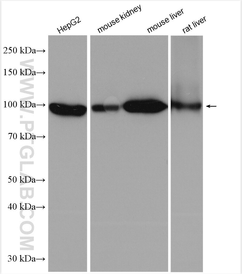 Western Blot (WB) analysis of various lysates using DHTKD1 Polyclonal antibody (27493-1-AP)