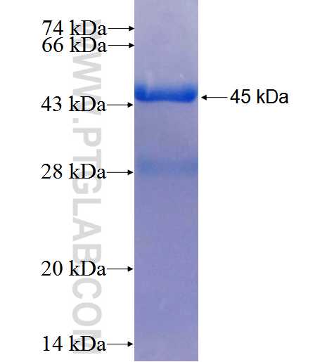 DHTKD1 fusion protein Ag26515 SDS-PAGE