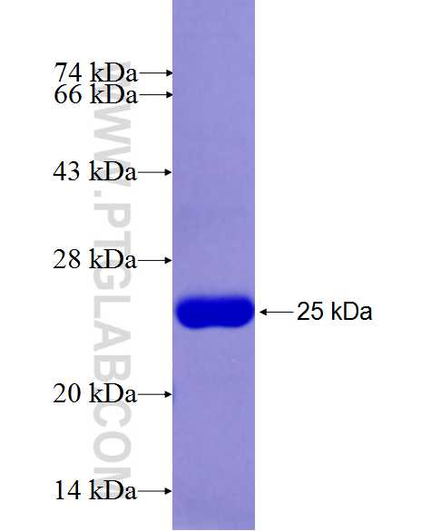 DHTKD1 fusion protein Ag26542 SDS-PAGE