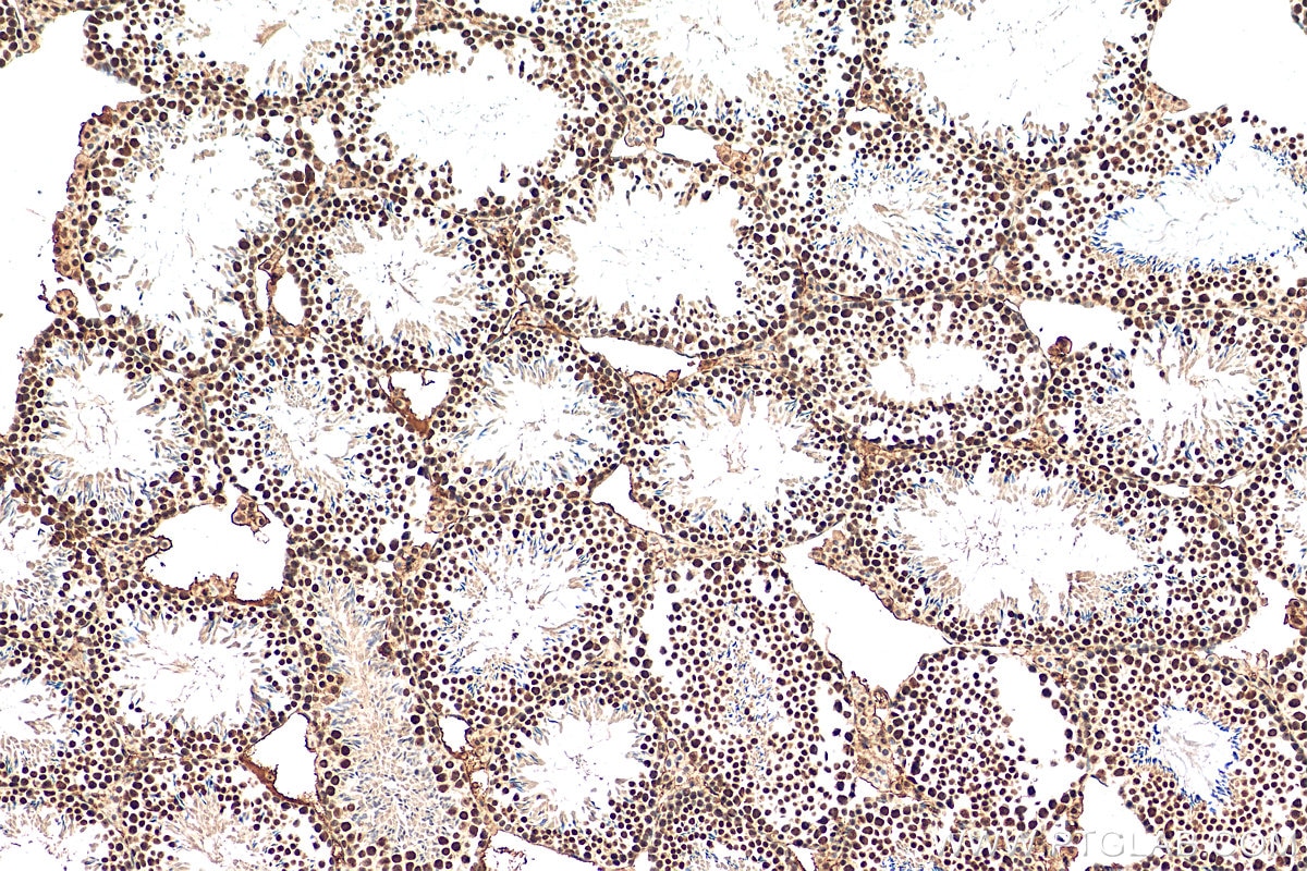 IHC staining of mouse testis using 12265-1-AP