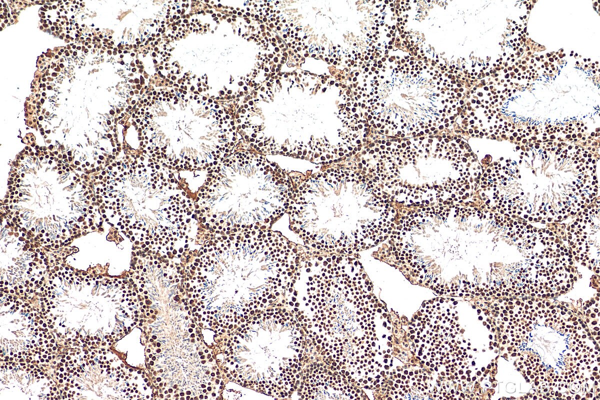 Immunohistochemistry (IHC) staining of mouse testis tissue using DHX15 Polyclonal antibody (12265-1-AP)