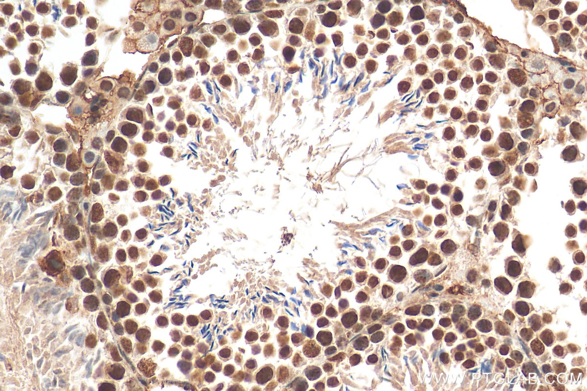 Immunohistochemistry (IHC) staining of mouse testis tissue using DHX15 Polyclonal antibody (12265-1-AP)