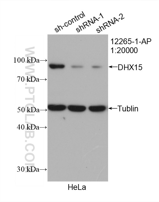 Western Blot (WB) analysis of HeLa cells using DHX15 Polyclonal antibody (12265-1-AP)