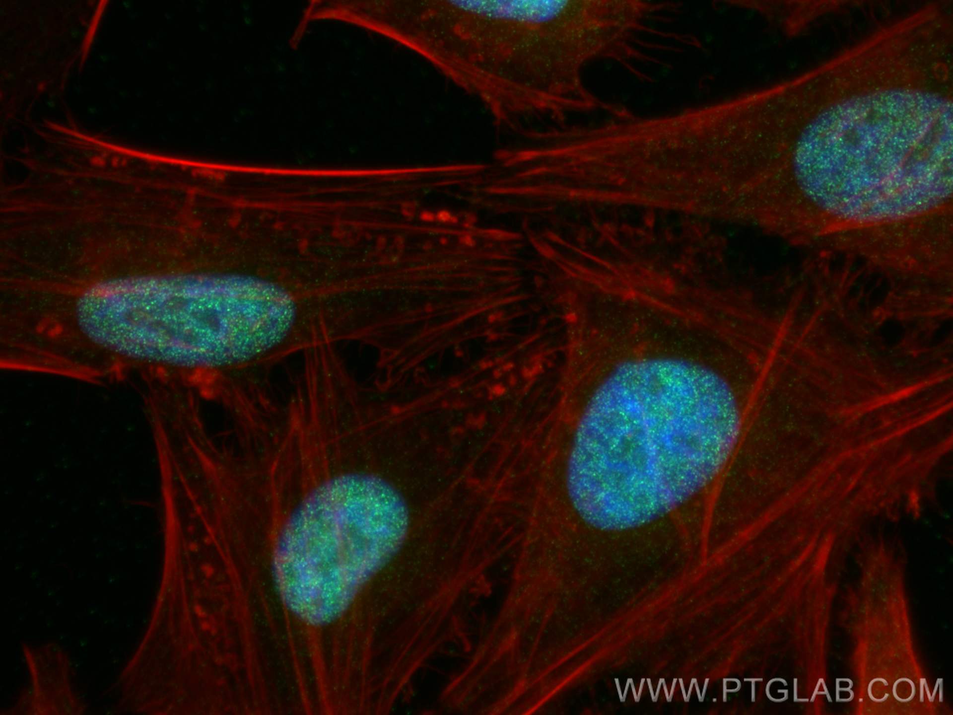 Immunofluorescence (IF) / fluorescent staining of HeLa cells using DHX15 Recombinant antibody (82137-1-RR)