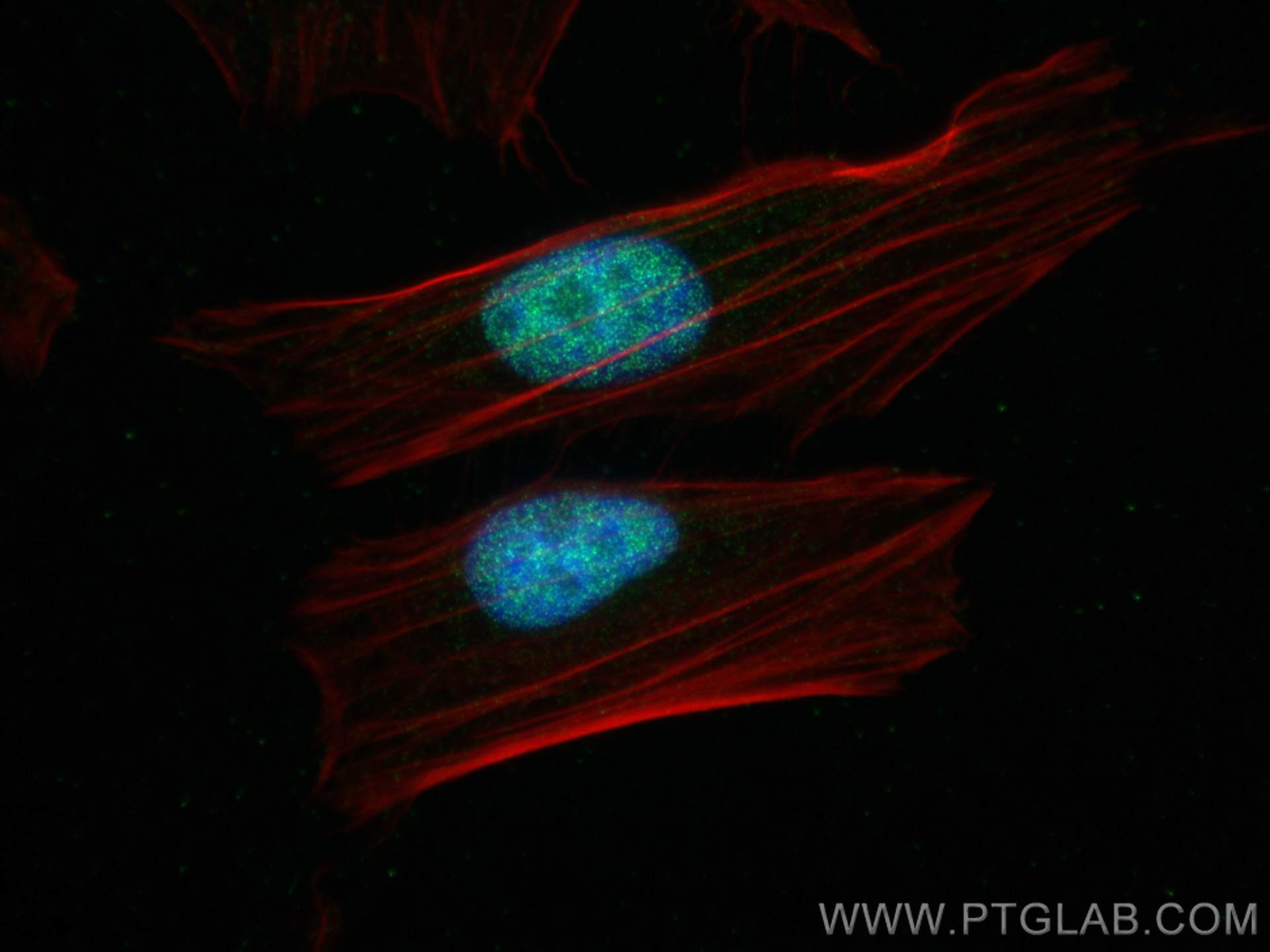 Immunofluorescence (IF) / fluorescent staining of HeLa cells using DHX15 Recombinant antibody (82137-1-RR)