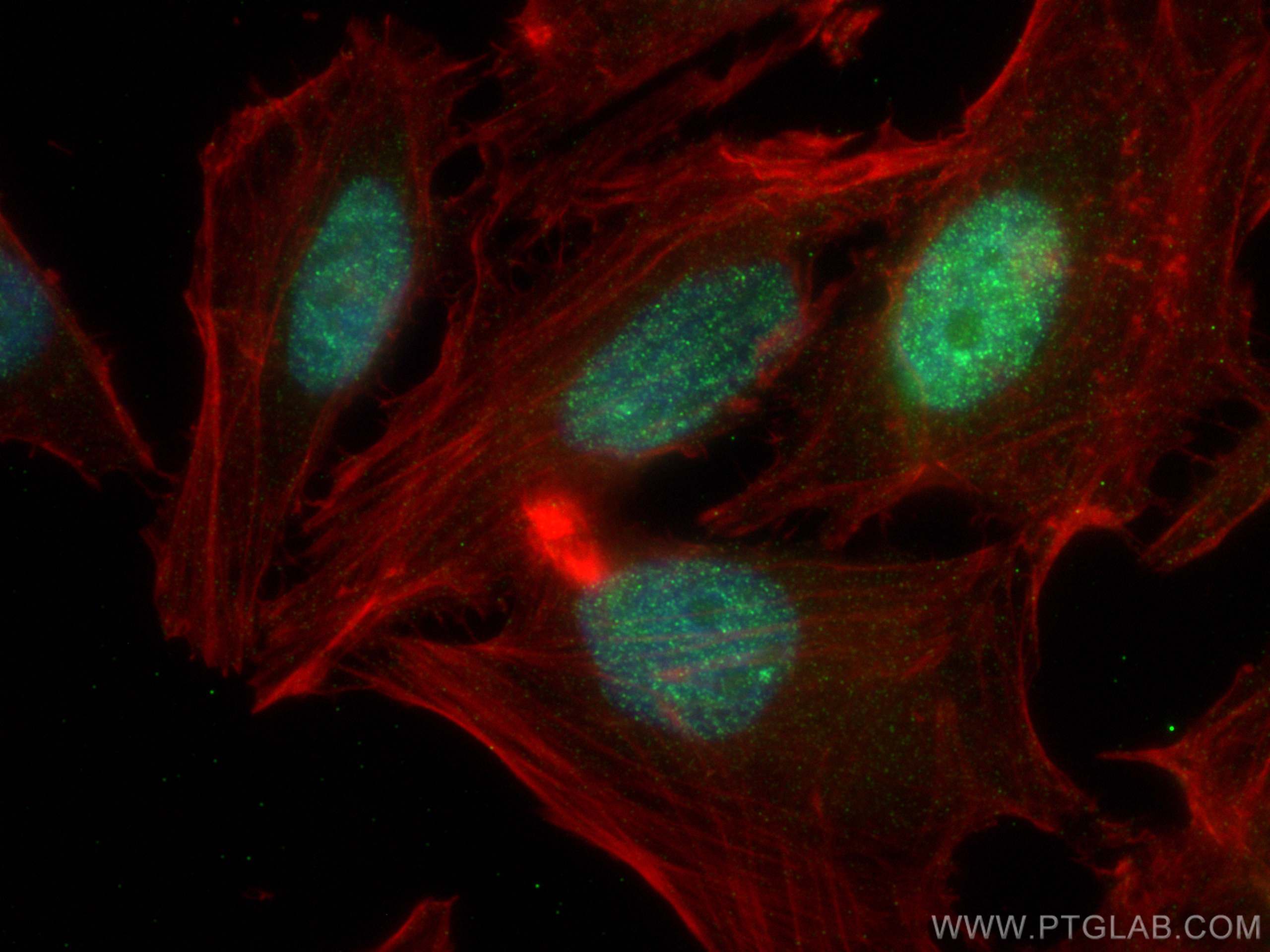 Immunofluorescence (IF) / fluorescent staining of HeLa cells using DHX15 Recombinant antibody (82137-1-RR)