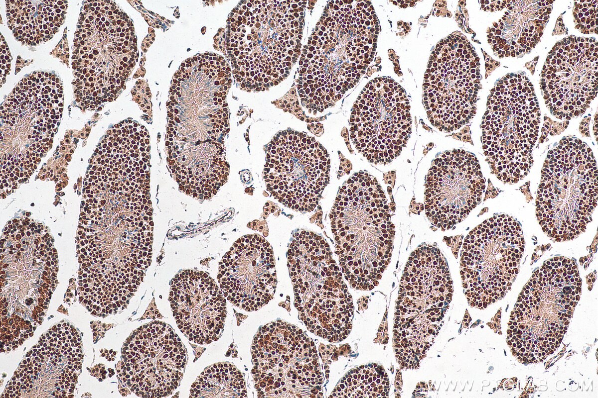 Immunohistochemistry (IHC) staining of mouse testis tissue using DHX15 Recombinant antibody (82137-1-RR)