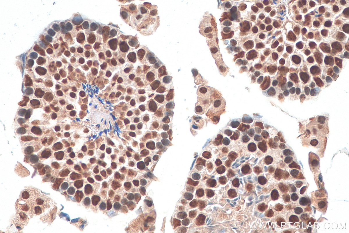 Immunohistochemistry (IHC) staining of mouse testis tissue using DHX15 Recombinant antibody (82137-1-RR)