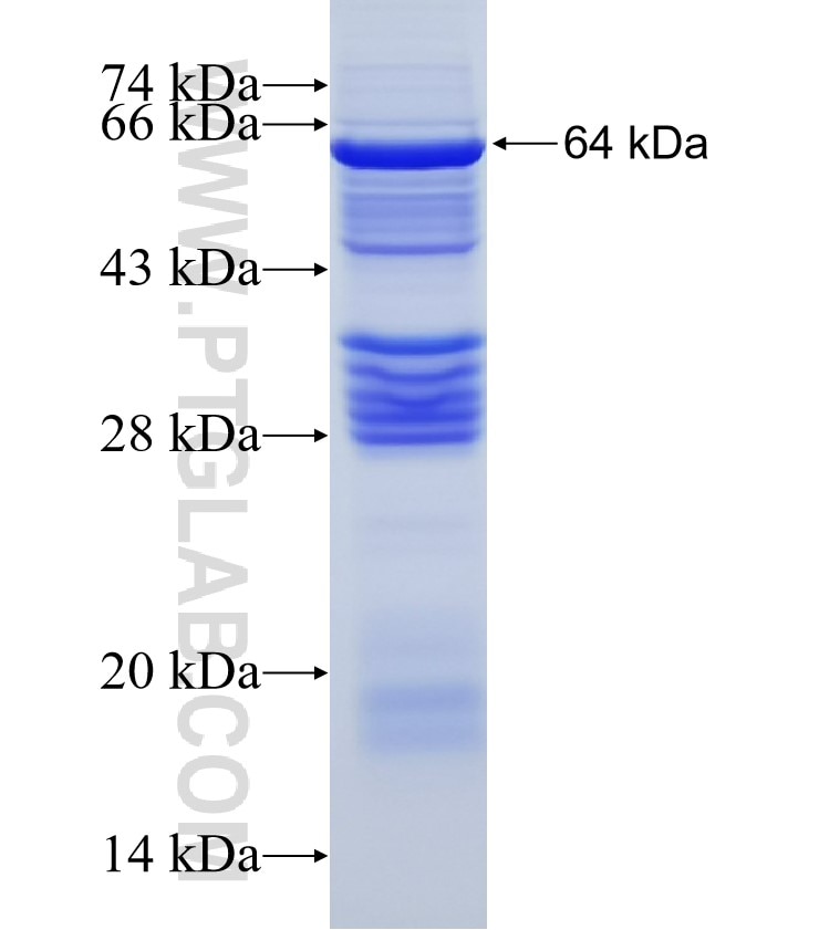 DHX15 fusion protein Ag2895 SDS-PAGE
