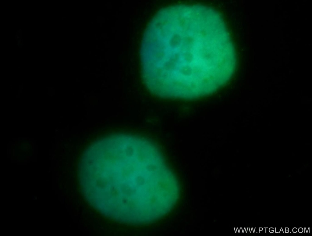Immunofluorescence (IF) / fluorescent staining of MCF-7 cells using DHX16 Polyclonal antibody (11021-1-AP)