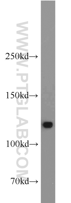 Western Blot (WB) analysis of Jurkat cells using DHX16 Polyclonal antibody (11021-1-AP)