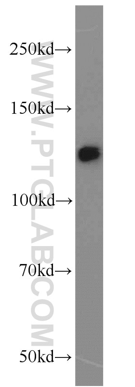 Western Blot (WB) analysis of HeLa cells using DHX16 Polyclonal antibody (11021-1-AP)