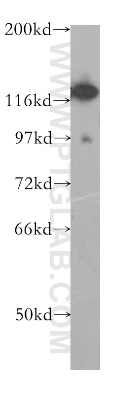 Western Blot (WB) analysis of human brain tissue using DHX16 Polyclonal antibody (11021-1-AP)