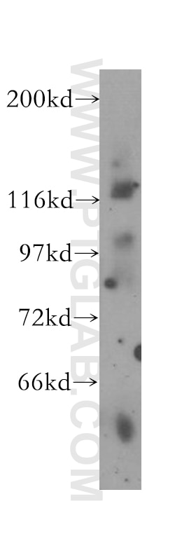 Western Blot (WB) analysis of mouse testis tissue using DHX16 Polyclonal antibody (11021-1-AP)