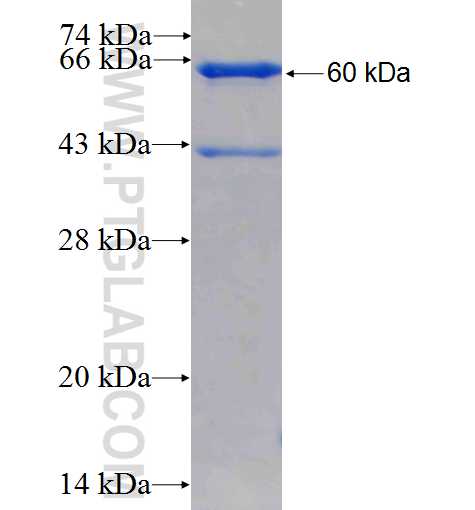 DHX16 fusion protein Ag1482 SDS-PAGE