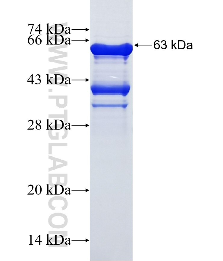 DHX16 fusion protein Ag1482 SDS-PAGE