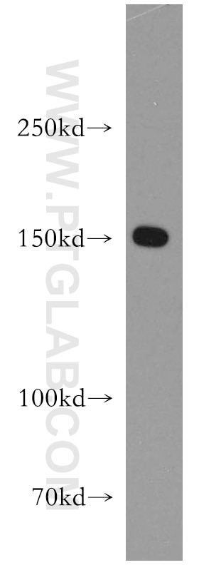 Western Blot (WB) analysis of HEK-293 cells using DHX29 Polyclonal antibody (13923-1-AP)