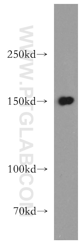 Western Blot (WB) analysis of K-562 cells using DHX29 Polyclonal antibody (13923-1-AP)