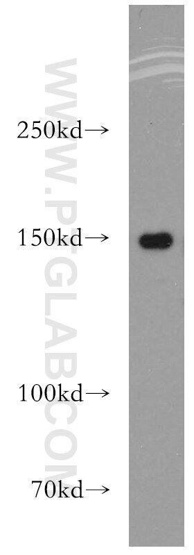 Western Blot (WB) analysis of PC-3 cells using DHX29 Polyclonal antibody (13923-1-AP)
