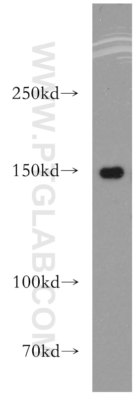 WB analysis of PC-3 using 13923-1-AP